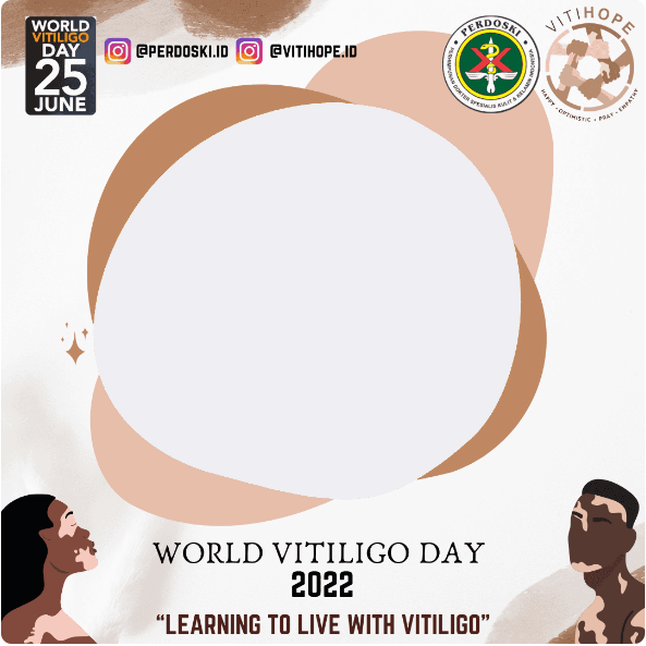 Download Twibbon Hari Vitiligo Sedunia Tahun 2022